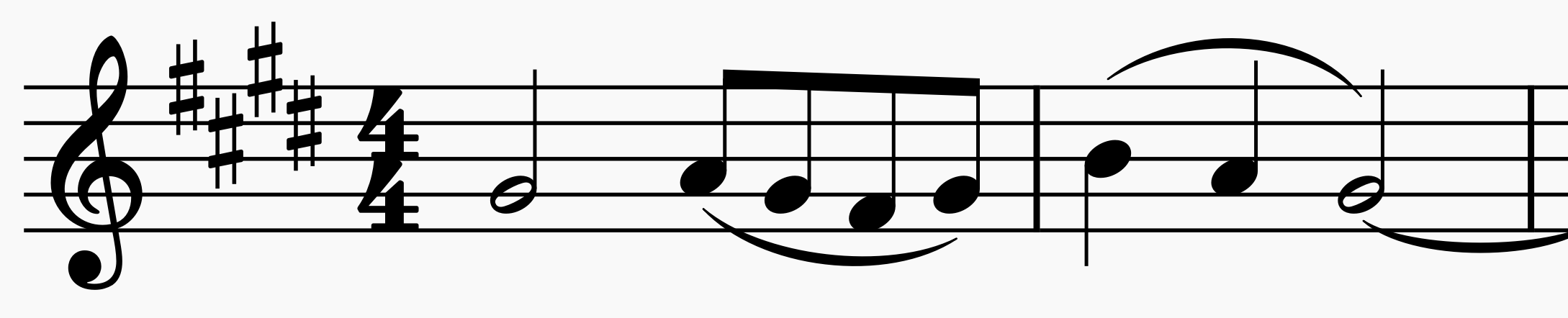 Musical notation of a frequently used motif in my compositions involving a turn.